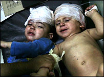 A Palestinian woman killed, 46 injured in a fresh Israeli air strike